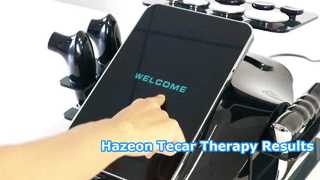 Mesin Terapi Hazeon Tecar RL-W20 – Perangkat Fisioterapi & Rehabilitasi 448kHz Canggih