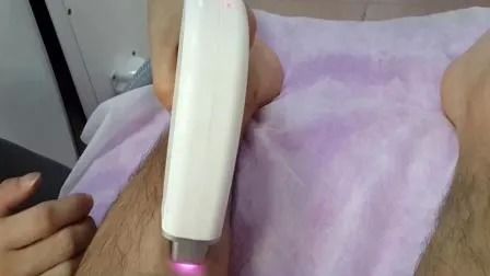 Mesin Penghilang Rambut Laser Dioda 808nm dengan Energi 1-50A Lebar Pulsa 1-400ms untuk 6 Jenis Kulit